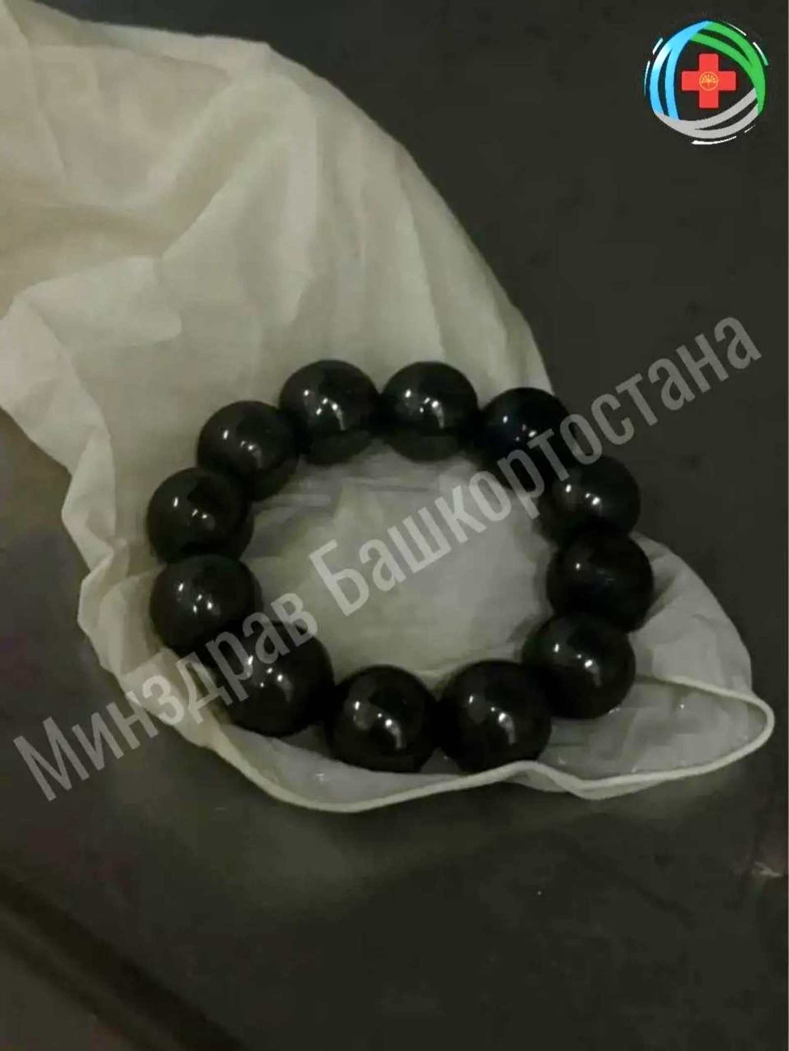 В Уфе врачи спасли девочку, проглотившую 12 магнитных шариков